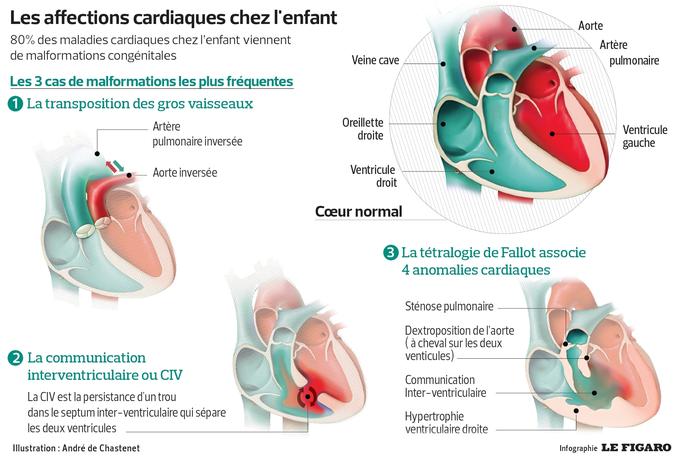 Chacune de ces malformations congénitales demande un suivi spécifique. Mais l’adolescence et l’entrée dans l’âge adulte sont des périodes critiques, parce qu’ils se sentent en forme, ne veulent pas être embêtés avec leur maladie…