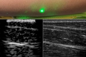 ultrasound probe