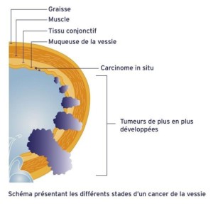 sonde echographique 2D