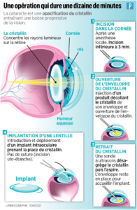 lyonnais de réparation de sonde